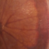 Grapefruit Slice